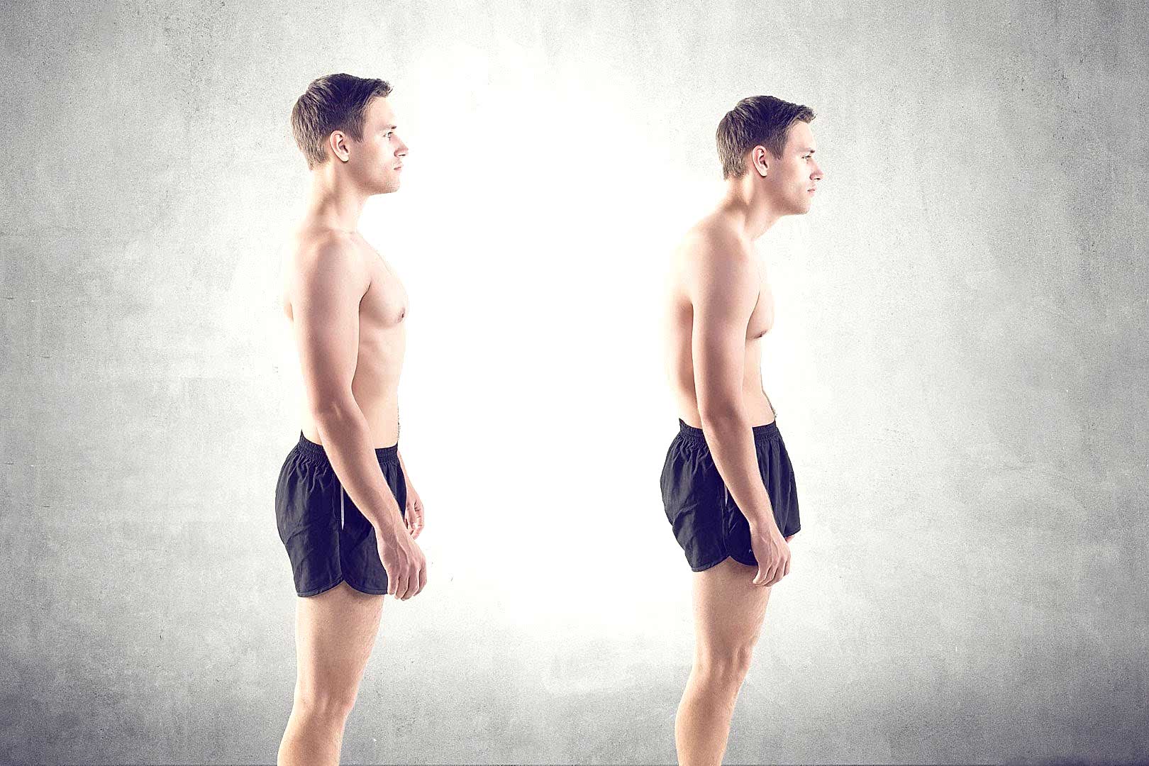 Ameliyatsız Kamburluk (Kifoz) Tedavisi